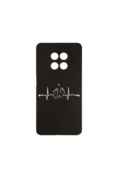bestcase ¬Æ Husa Slim SIlicon 0.8MM, Compatibila Cu Realme 12 5G, My Little L...