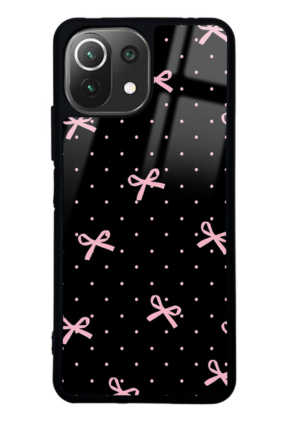 Spoyi Xiaomi Mi 11 Lite Pembe Kurdele Tasarımlı Glossy Telefon Kılıfı