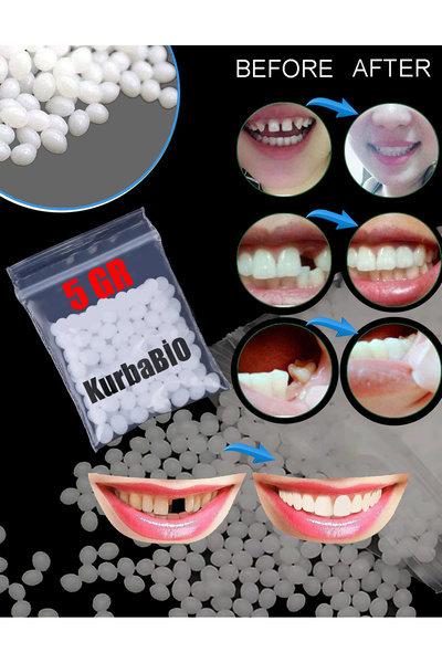 KURBE Pro Thermo Granül 5 Gram Protez Geçici Diş Yapımı, Eksik Diş Giderme, K...