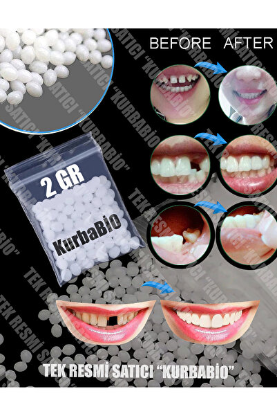KURBE 2 Gram Granül Toksik olmayan Eksik Diş Tamamlama, Diş Boşluk kapatma Ta...