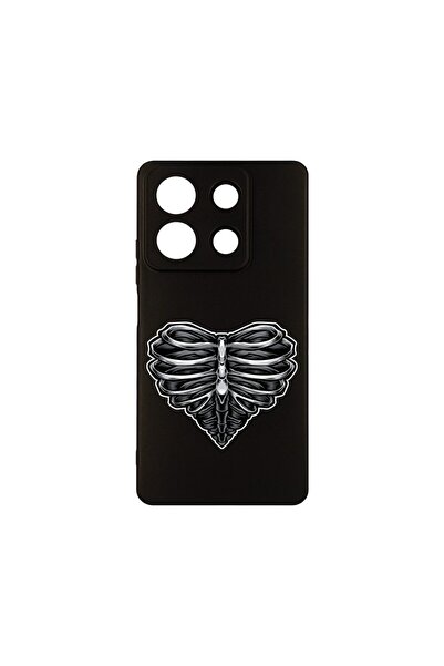 bestcase Husa BestCase¬Æ Slim SIlicon 0.8MM, Compatibila Cu Xiaomi Redmi Note...