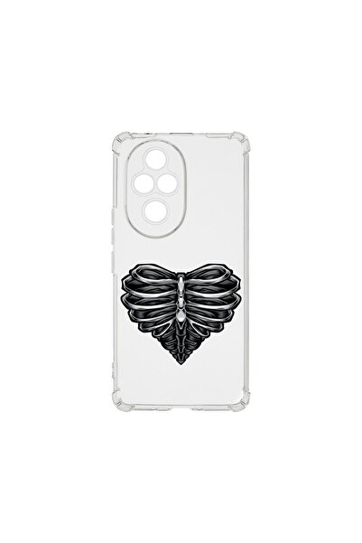 bestcase ¬Æ Husa Anti Shock 1.5MM, Compatibila Cu Honor 200 Pro, Skeleton Hea...