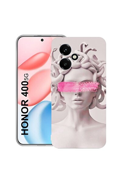 bestcase Διαφανής Θήκη Σιλικόνης για Honor 400, Μέδουσα, 2036423 T 1289