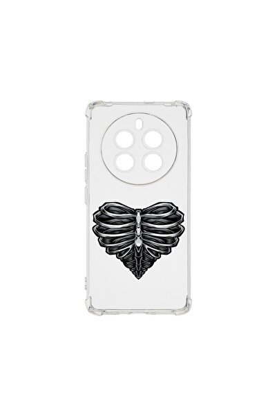 bestcase ¬Æ Husa Anti Shock 1.5MM, Compatibila Cu Realme 12 Pro, Skeleton Hea...