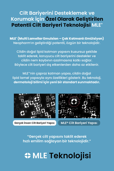 Atopalm Atopik Ciltlere Özel, Pantenol İçerikli, Hafif Yapılı Nemlendirici Losyon Panthenol Lotion