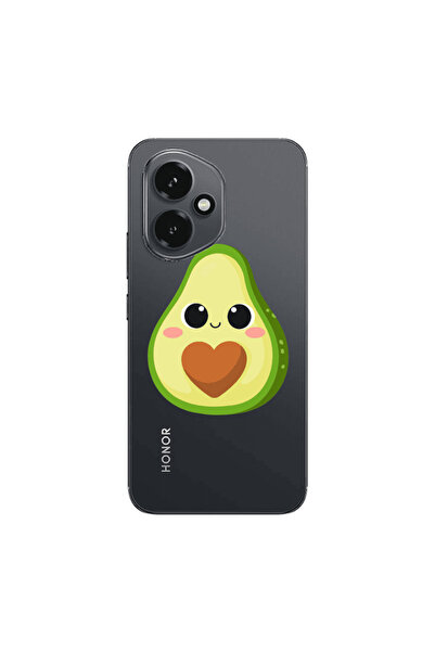Other Honor Magic 400 Baby avocado Transparent Silicone TPU Θήκη
