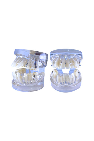 Smilz Maxillary Teeth Structure Jaw Model for Dentistry Student and Clinician