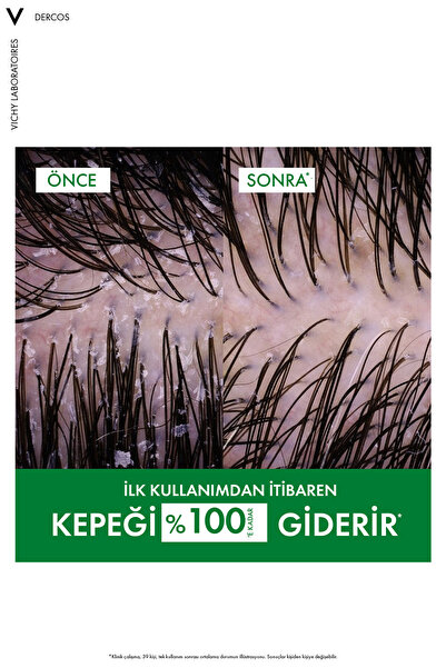 Vichy Dercos Anti-Dandruff Şampuan Kepek Karşıtı Normal ve Yağlı Saçlar İçin 200 ml