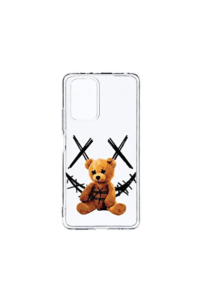 bestcase Прозрачен силиконов калъф 2ММ, съвместим с Xiaomi Redmi Note 10 Pro ...