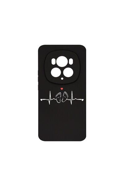 bestcase Θήκη Σιλικόνης Premium, Συμβατή με Honor Magic6 Pro, My Little Love,...