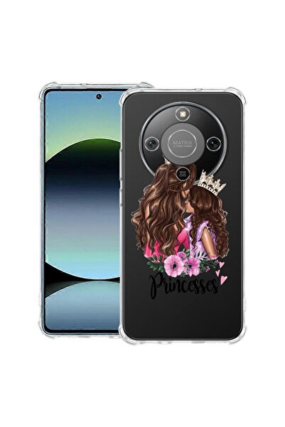 bestcase ¬Æ Husa Anti Shock 1.5mm Compatibila cu Honor Magic8 Lite, cu Design...
