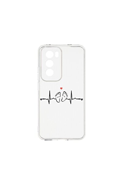 bestcase Διαφανής Θήκη Σιλικόνης 2MM, Συμβατή με OPPO Reno12 Pro 5G, My Littl...