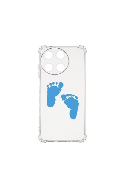bestcase Husa BestCase¬Æ Anti Shock 1.5MM, Compatibila Cu Realme 11 4G, Boy F...