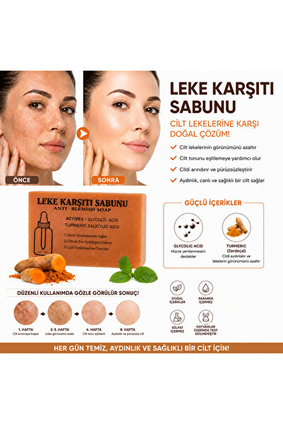 KingPower Hürrem Leke Karşıtı Sabunu 120 Gr Tüm Cilt Tipleri İçin Nemlendiric...