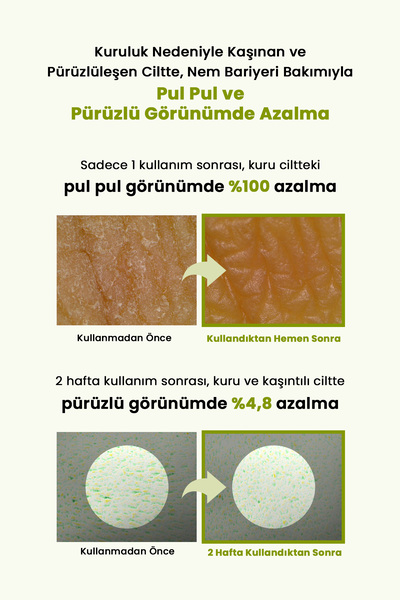 zeroid Aşırı Kuru Hassas Cilde Bariyer Desteği Sunan Yoğun Nemlendirici Losyon Intensive Lotion