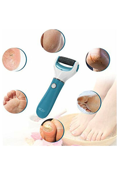 HYVESTO Pila Electrica Profesionala pentru Indepartarea Calusului si Curatarea Calcailor, Cap Rotativ 360° cu 1000 RPM, 2 Capete Abrazive cu Micro-Minerale, Alimentare Baterii, Ergonomica, Alb/Albastru