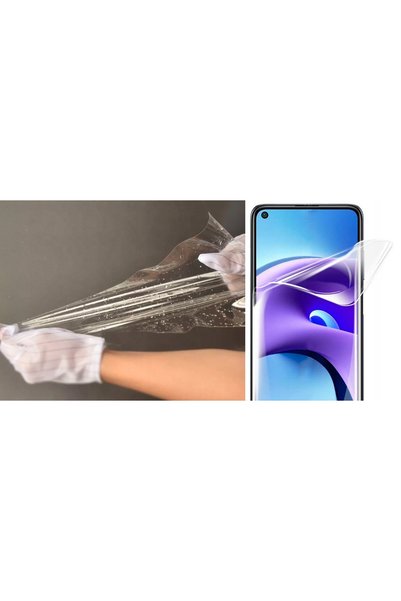 NO BRAND Folie de protecție din hidrogel Alogy pentru orice telefon