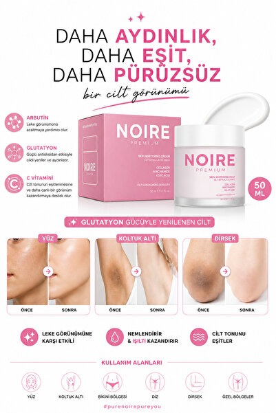 NOIRE PREMIUM Cilt Beyazlatıcı & Ton Eşitleyici Krem - Genital Bölge– Leke Te...