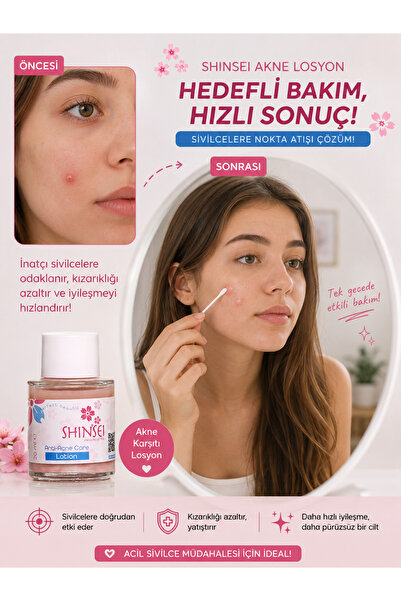 Gözenek Sıkılaştırıcı Siyah Nokta Karşıtı Losyon