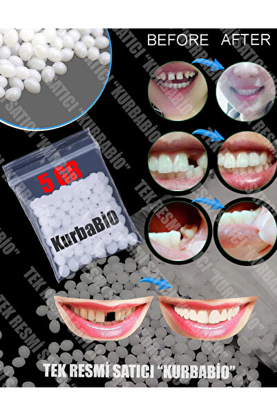 KURBE Pro Thermo Granül 5 Gram Diş Yapım Granülleri, Eksik Diş Giderme, Kırık...
