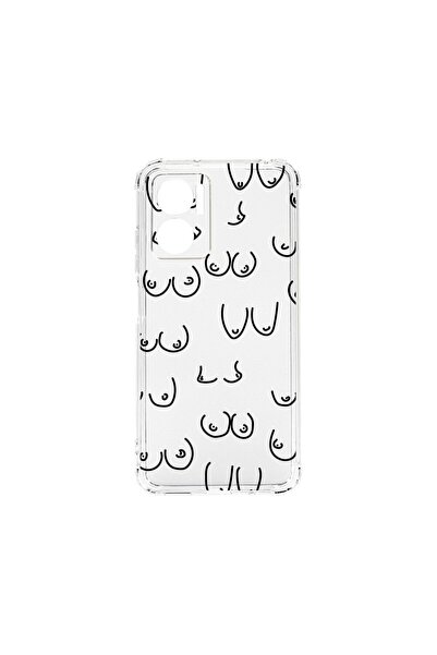 bestcase Husa BestCase¬Æ Anti Shock 1,5mm, Compatibila Cu Xiaomi Redmi 10 5G,...