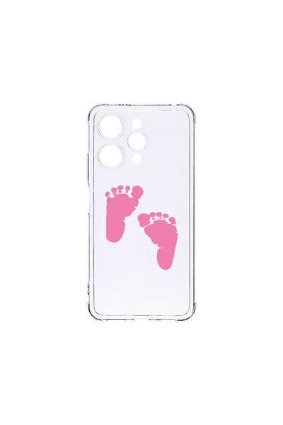 bestcase Αντικραδασμική Θήκη 1.5MM, Συμβατή με Xiaomi Redmi 12 4G, Σχέδιο Ποδ...