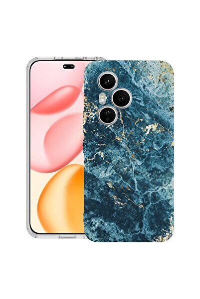 bestcase Прозрачен силиконов калъф за Honor 400 Pro, Мраморен - Зелен и злате...