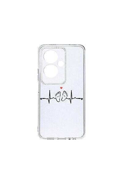 bestcase Husa BestCase¬Æ Διαφανής Σιλικόνη 2MM, Συμβατή με OPPO A79 5G, My Li...