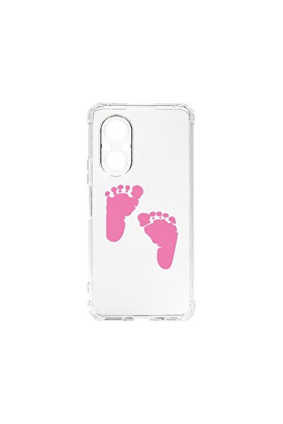 bestcase Husa BestCase¬Æ Anti Shock 1,5mm, Compatibila Cu Huawei Nova 9 SE, G...