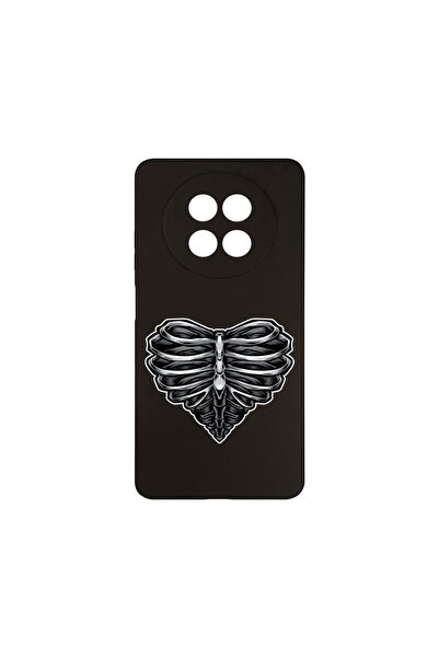 bestcase ¬Æ Husa Slim SIlicon 0.8MM, Compatibila Cu Realme 12 5G, Skeleton He...