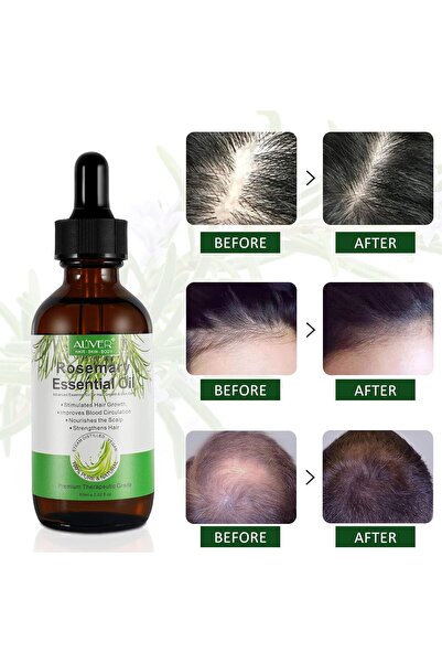 ALİVER Rosemary Oil for Hair Growth 2 Fl Oz, Pure Organic Rosemary Essential ...