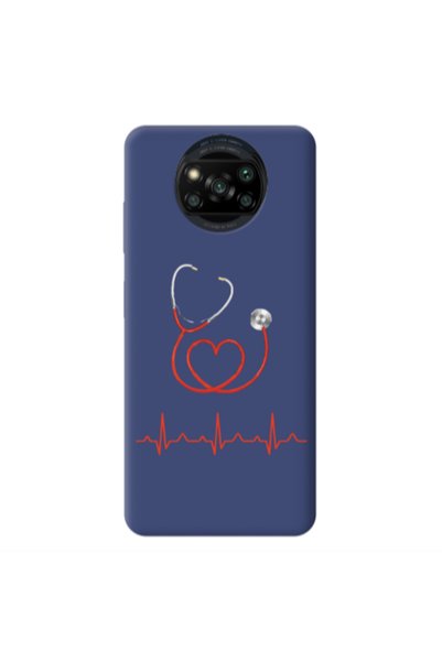 Other Xiaomi Poco X3 /X3 Pro Stethoscope Dark blue Colored Silicone TPU Θήκη