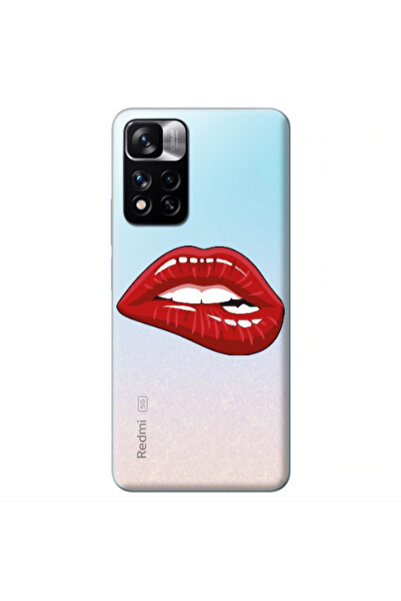 Other Xiaomi Redmi Note 11 Pro 5G Shiny Lips Transparent Silicone TPU Θήκη