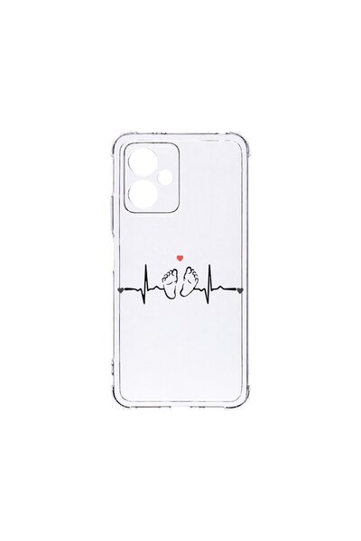 bestcase ¬Æ Husa Anti Shock 1.5MM, Compatibila Cu Motorola Moto G54 Power / M...