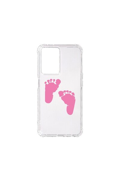 bestcase Husa BestCase¬Æ Anti Shock 1.5MM, Compatibila Cu OPPO A77 4G / A77 5...