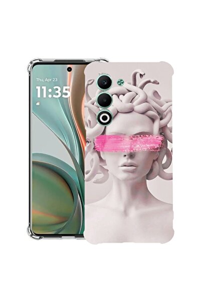 bestcase Αντικραδασμική Θήκη για OPPO A5 5G με Σχέδιο Μέδουσα, 2052056 AS 1289