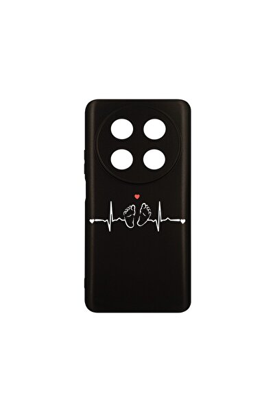bestcase Λεπτή Θήκη Σιλικόνης 0.8MM, Συμβατή με Huawei Nova 12i, My Little Lo...