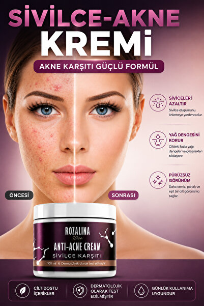 Rozalina Rise Vitamin İçeren Sîvîlce Önleyici Krem Siyah nokta ,Akne Karşıtı ...