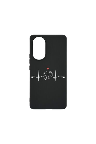 bestcase Husa BestCase¬Æ Slim SIlicon 0.8MM, Compatibila Cu Huawei Nova 9, My...