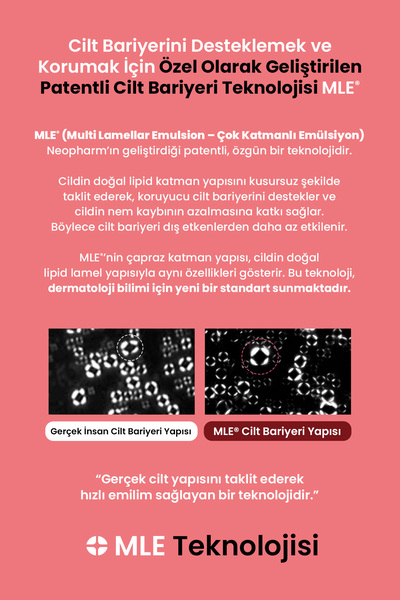 Atopalm Atopik Ciltlere Özel Cilt Bariyerini Destekleyen Yoğun Nemlendirici Krem MLE Cream 100 ml