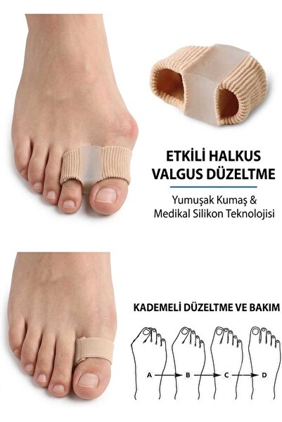 hipiylow 1 Adet Ayak Baş Parmak Kemik Eğriliği Düzeltici Parmak Koruyucu Silikon