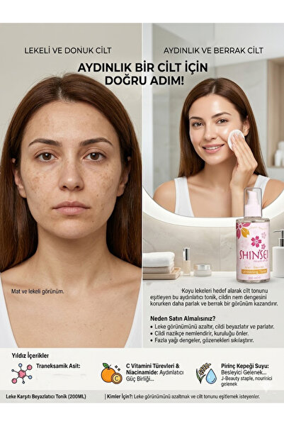 Leke Karşıtı Beyazlatıcı Tonik