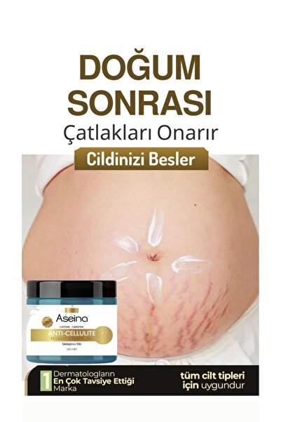 Aseina Llnceltici, Firming Cellulite and Stretch Mark Remover, Body Shaping A...
