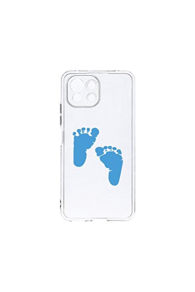 bestcase Διαφανής Θήκη Σιλικόνης 2MM, Συμβατή με Xiaomi Mi 11 Lite, Σχέδιο Πο...