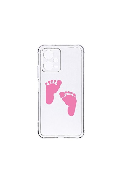 bestcase Husa BestCase¬Æ Anti Shock 1,5MM, Compatibila Cu Xiaomi Redmi Note 1...