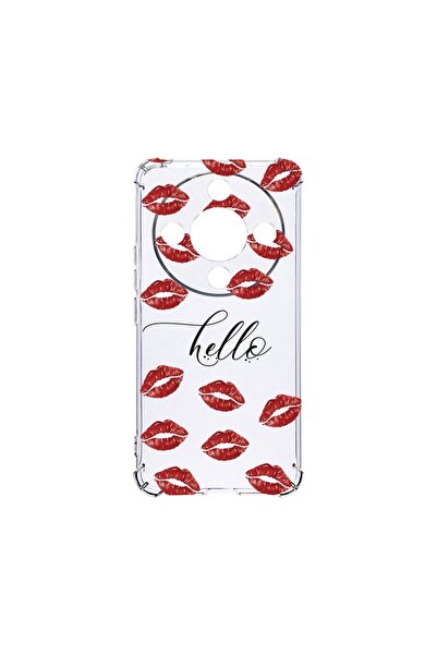 bestcase Αντικραδασμική Θήκη 1.5MM, Συμβατή με Honor Magic6 Lite, Hello Kisse...