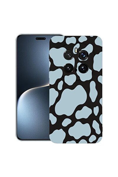 bestcase Θήκη για Honor Magic7 Pro, Προστατευτική Λεπτή Θήκη Σιλικόνης Premiu...