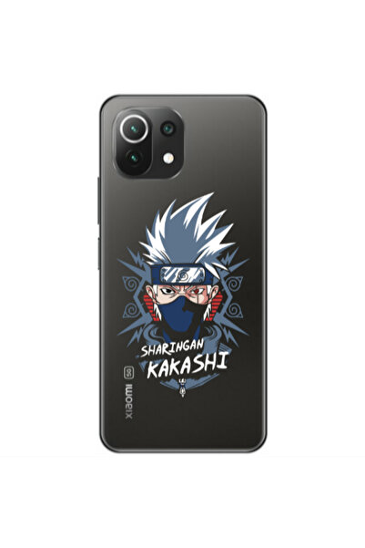 Other Xiaomi Mi 11 Lite Anime Mangoo Transparent Silicone TPU Θήκη