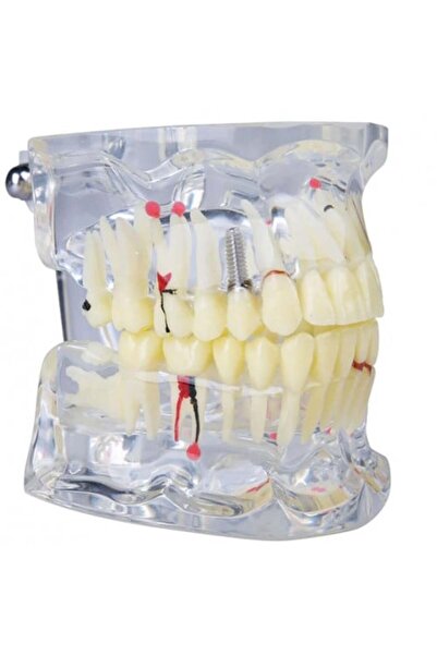 N-A Dental Anatomical Cast Model