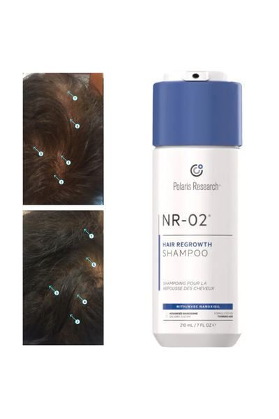 GYB Șampon – pentru alopecie androgenetică, Tratament împotriva căderii părul...
